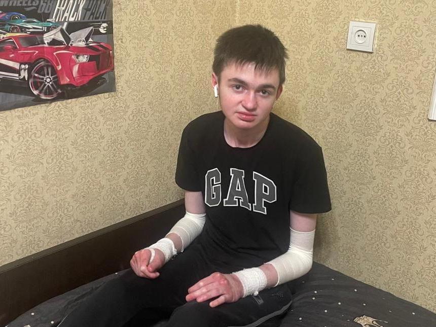 Саиду и 2 другим подопечным с буллезным эпидермолизом необходимо попасть в Москву на госпитализацию!