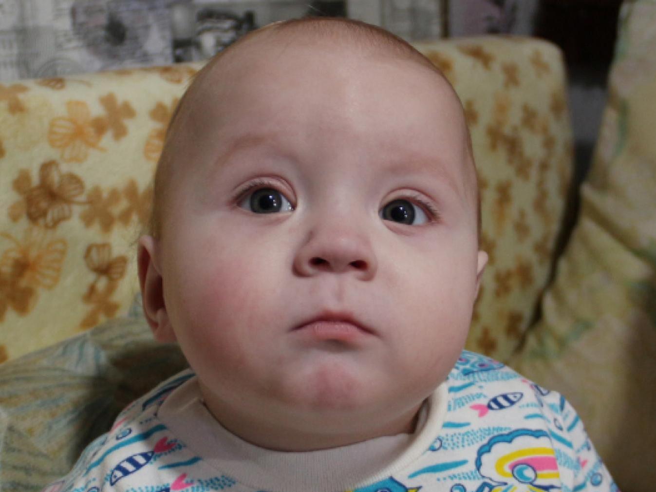 Slava has congenital lymphostasis of the leg, he needs surgery