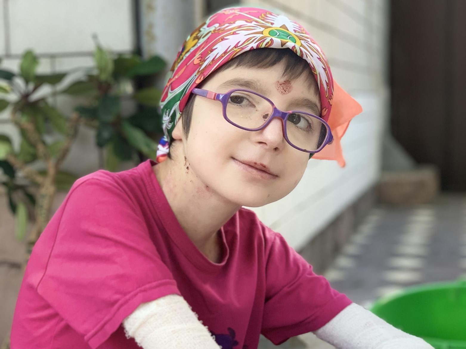 Асият нужны специальные бинты!