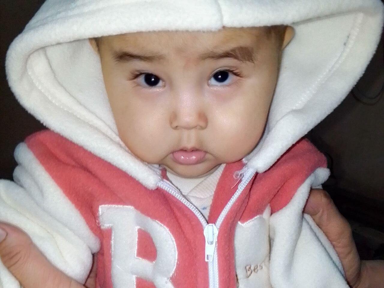 Fatimakho needs surgery to treat retinopathy of prematurity!