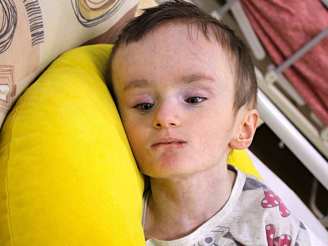 Anna and two other orphaned children need medical feeding equipment to gain weight!