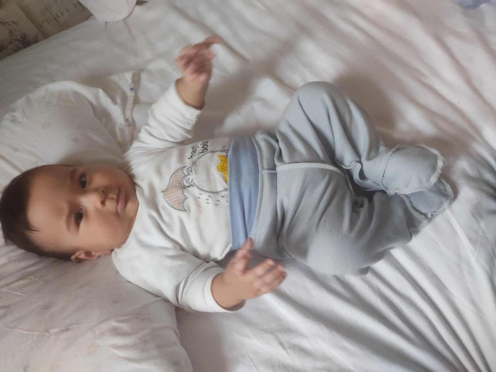 Umar needs chemotherapy to fight retinal cancer!