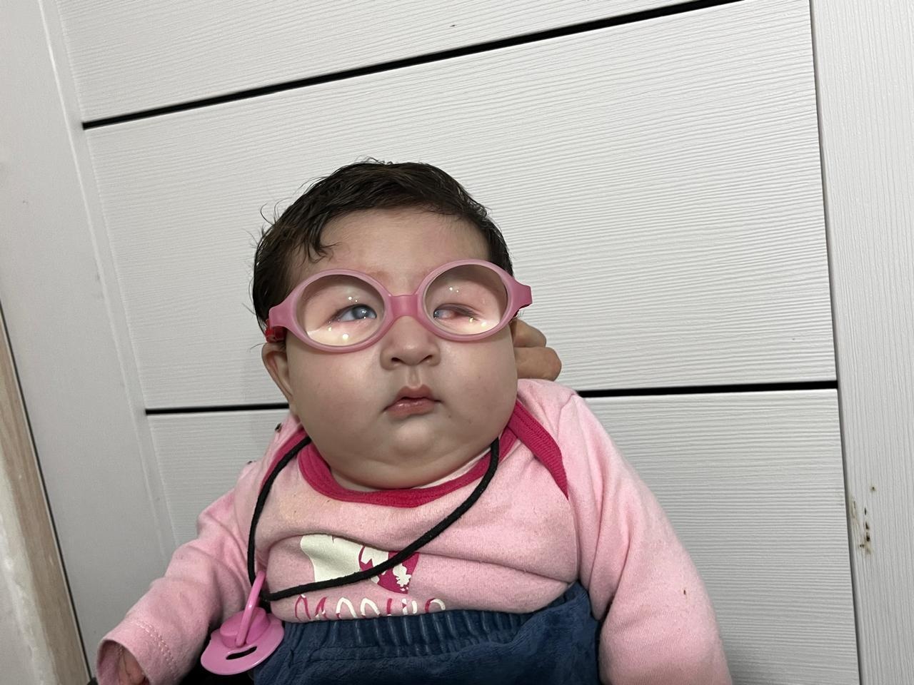 Айе необходимо продолжить лечение врожденного помутнения роговицы и микрофтальма!