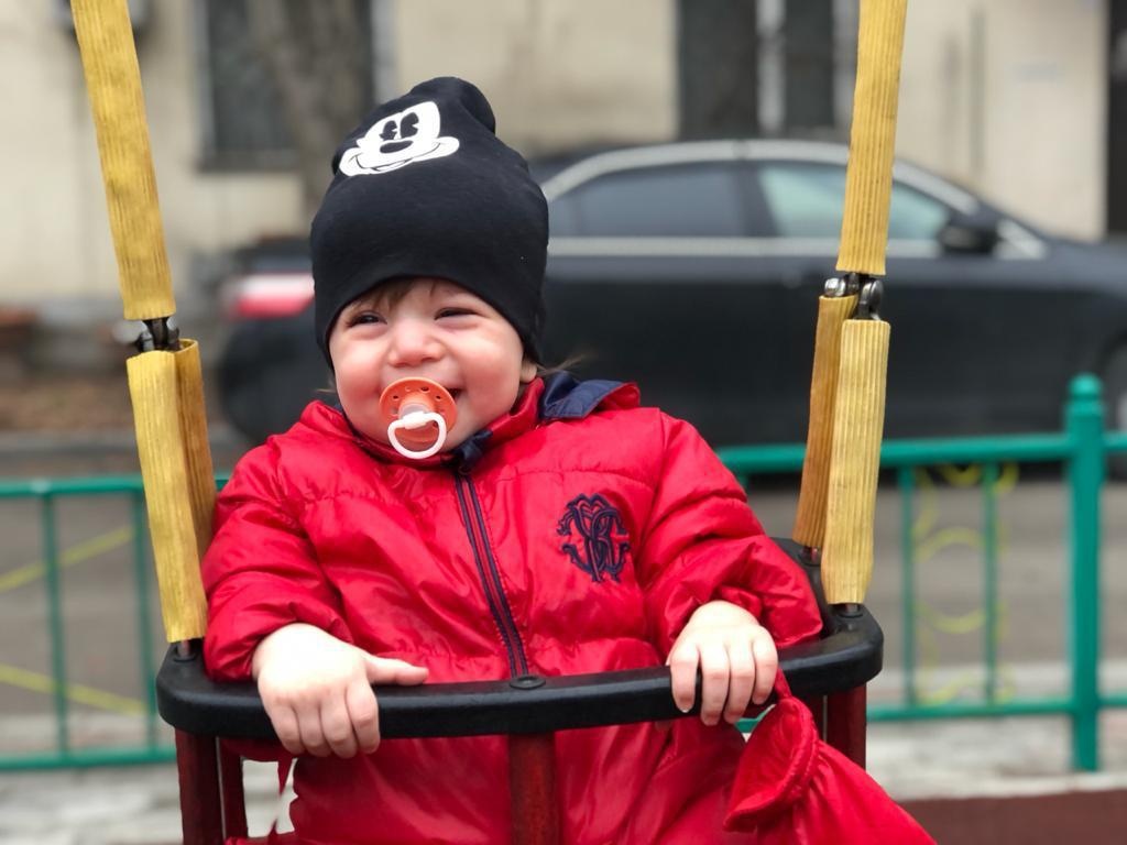 Ayla needs surgery to correct her skull deformity