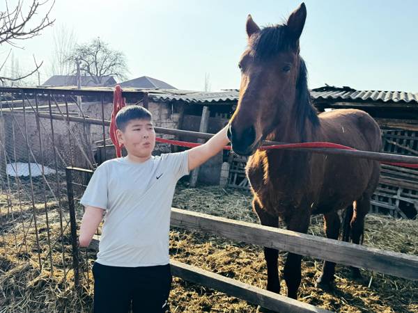 Элхан сильно пострадал от взрыва газа в доме. Ему требуется активный протез руки