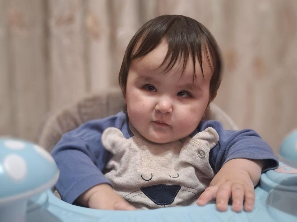 Умайре необходима операция для восстановления зрения.