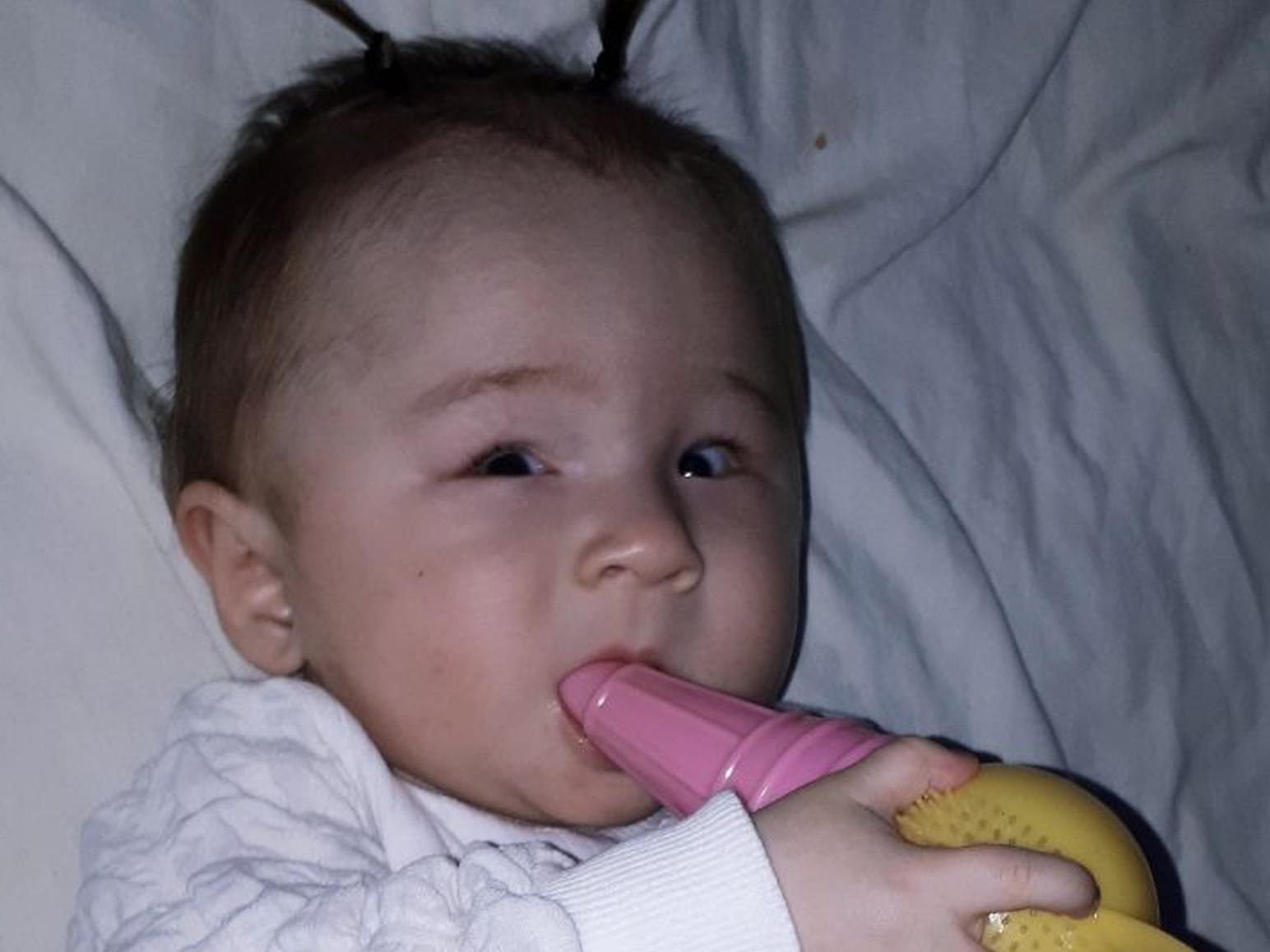 One-year-old Sanobar needs surgery to treat retinopathy of prematurity.