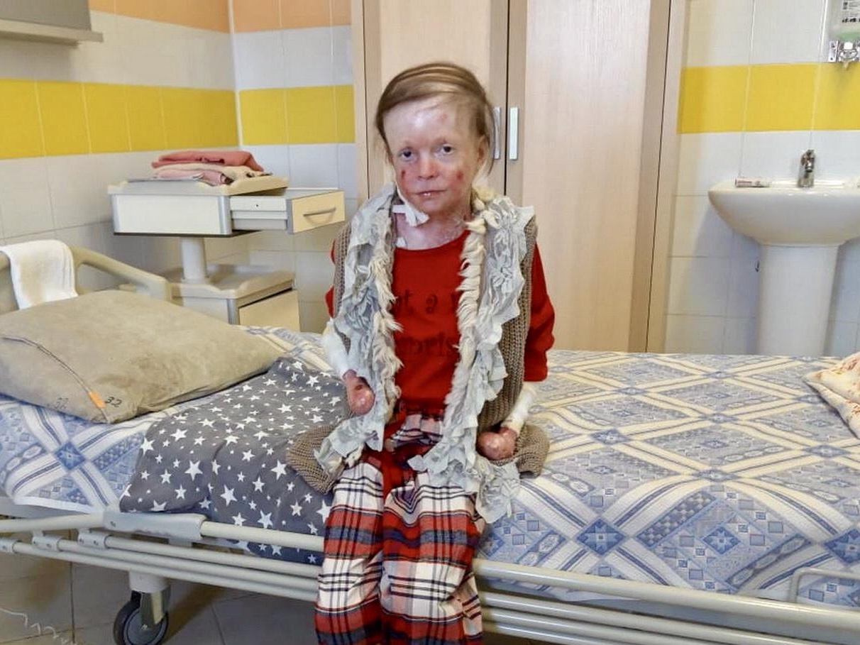 Maryam needs vital orthotics and bandages!