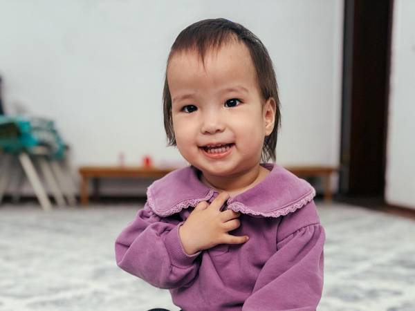 Асиме требуется операция на черепе из-за преждевременного сращения швов!