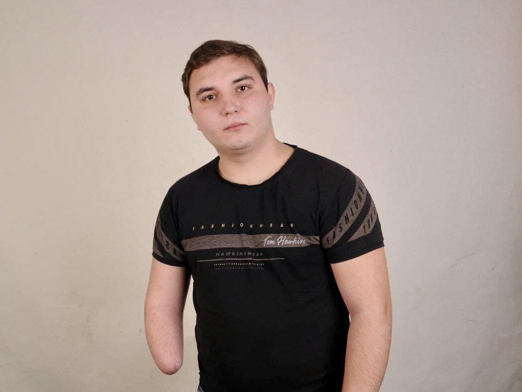 Данилу необходим бионический протез руки