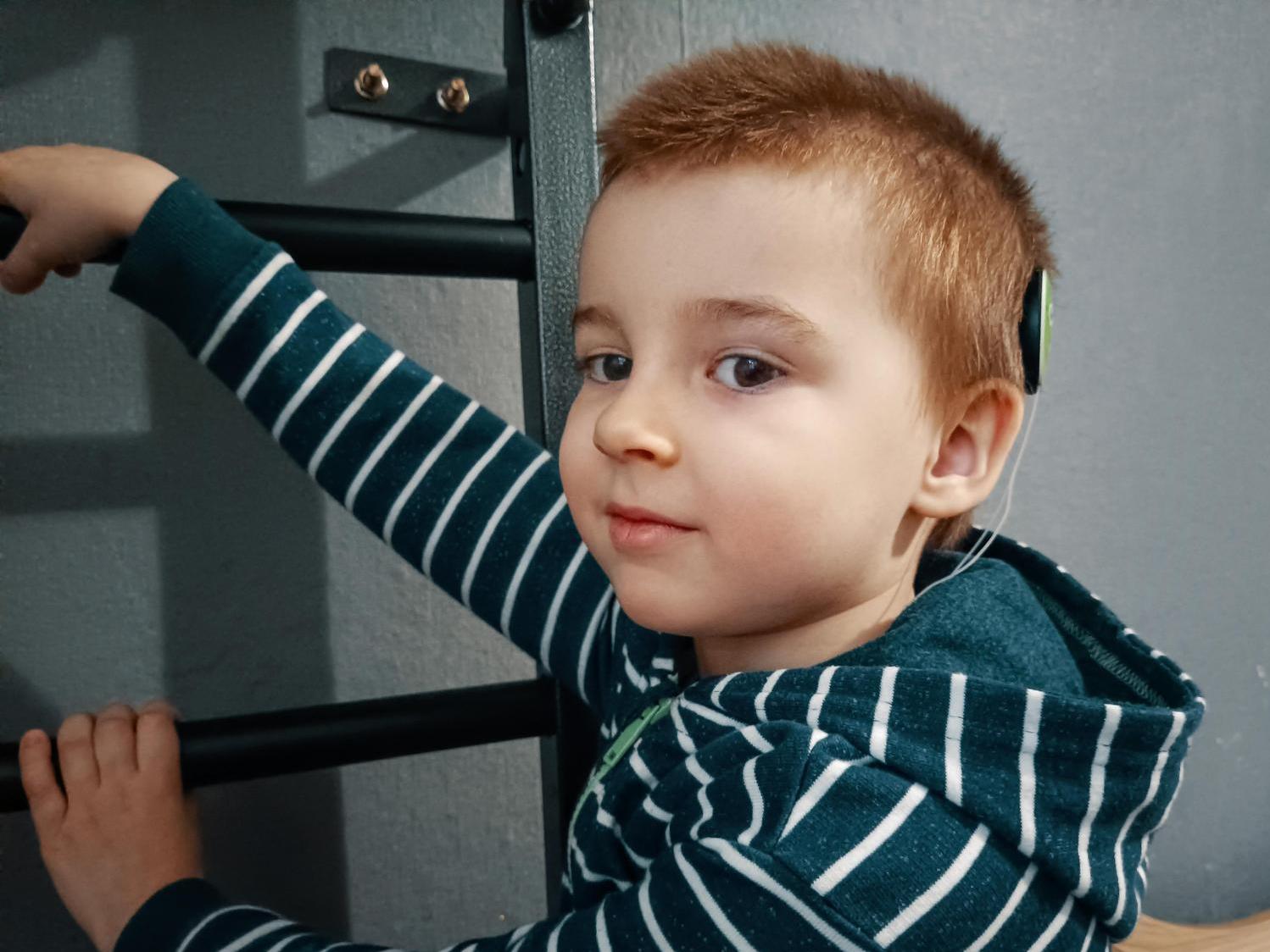 Misha underwent cochlear implantation. He needs auditory-speech rehabilitation to start speaking