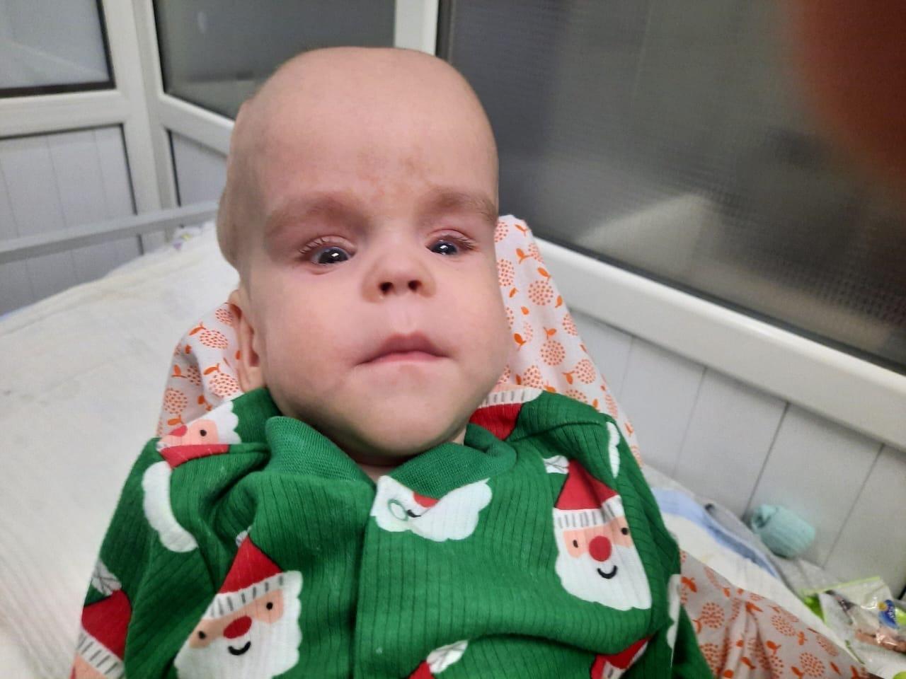 У Билала гидроцефалия и ретинопатия 5 стадии, ему нужна операция!