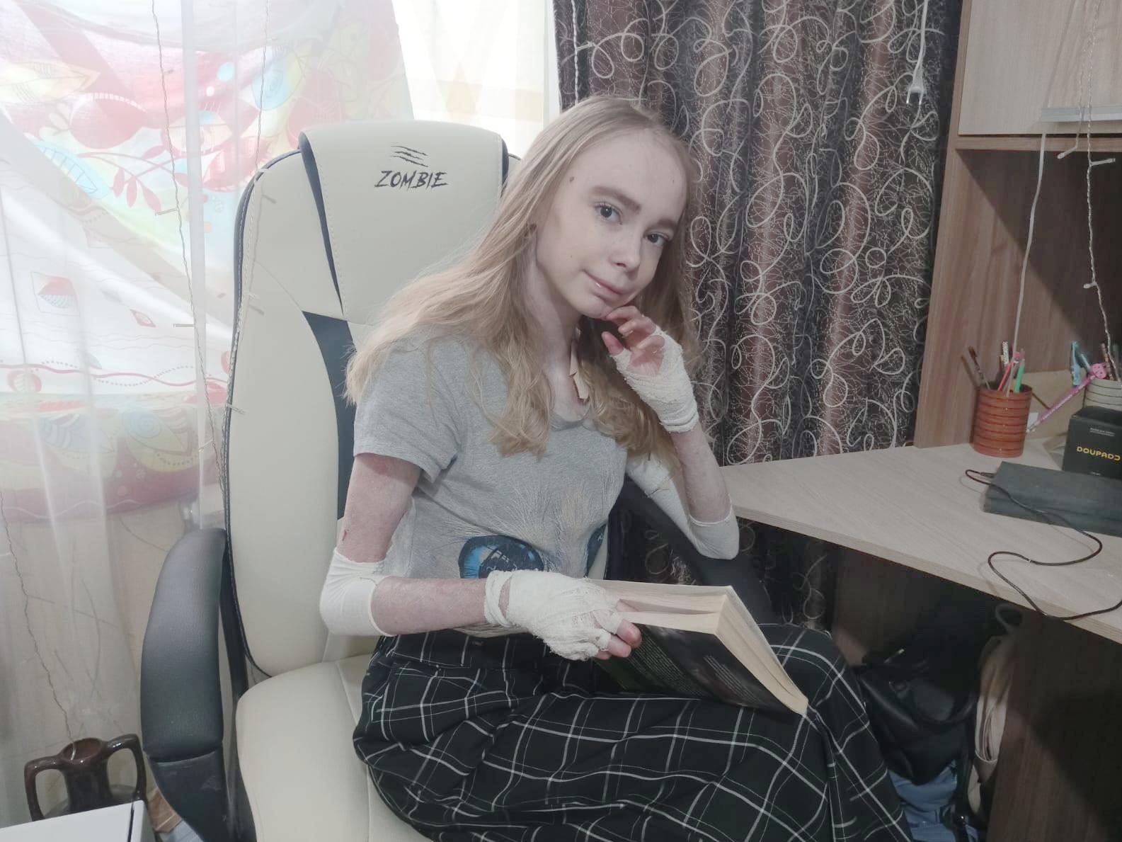 У Линнеты генетическое заболевание. Ежедневно ей нужны атравматические перевязочные материалы для защиты кожи