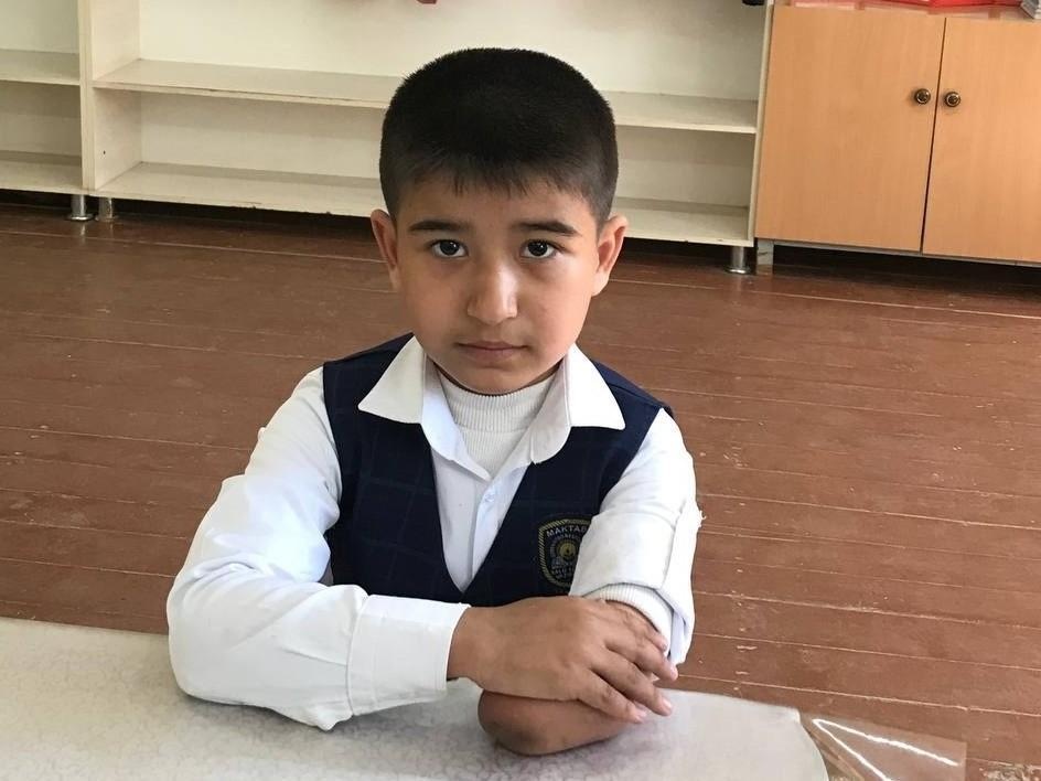Mirabror needs a prosthetic arm to continue living an active life
