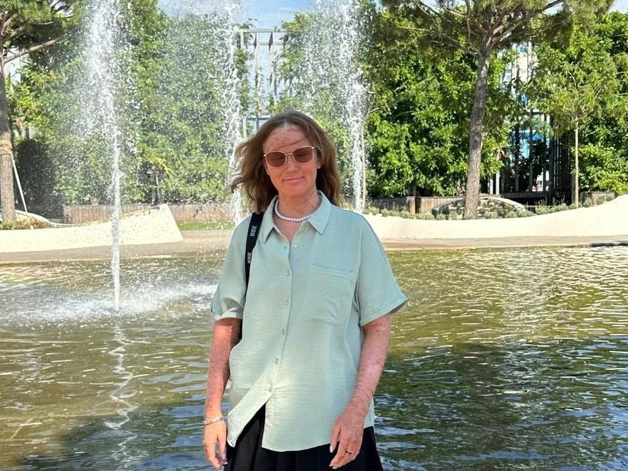 У Евы ихтиоз. Для защиты кожи ей необходимо специальное средство