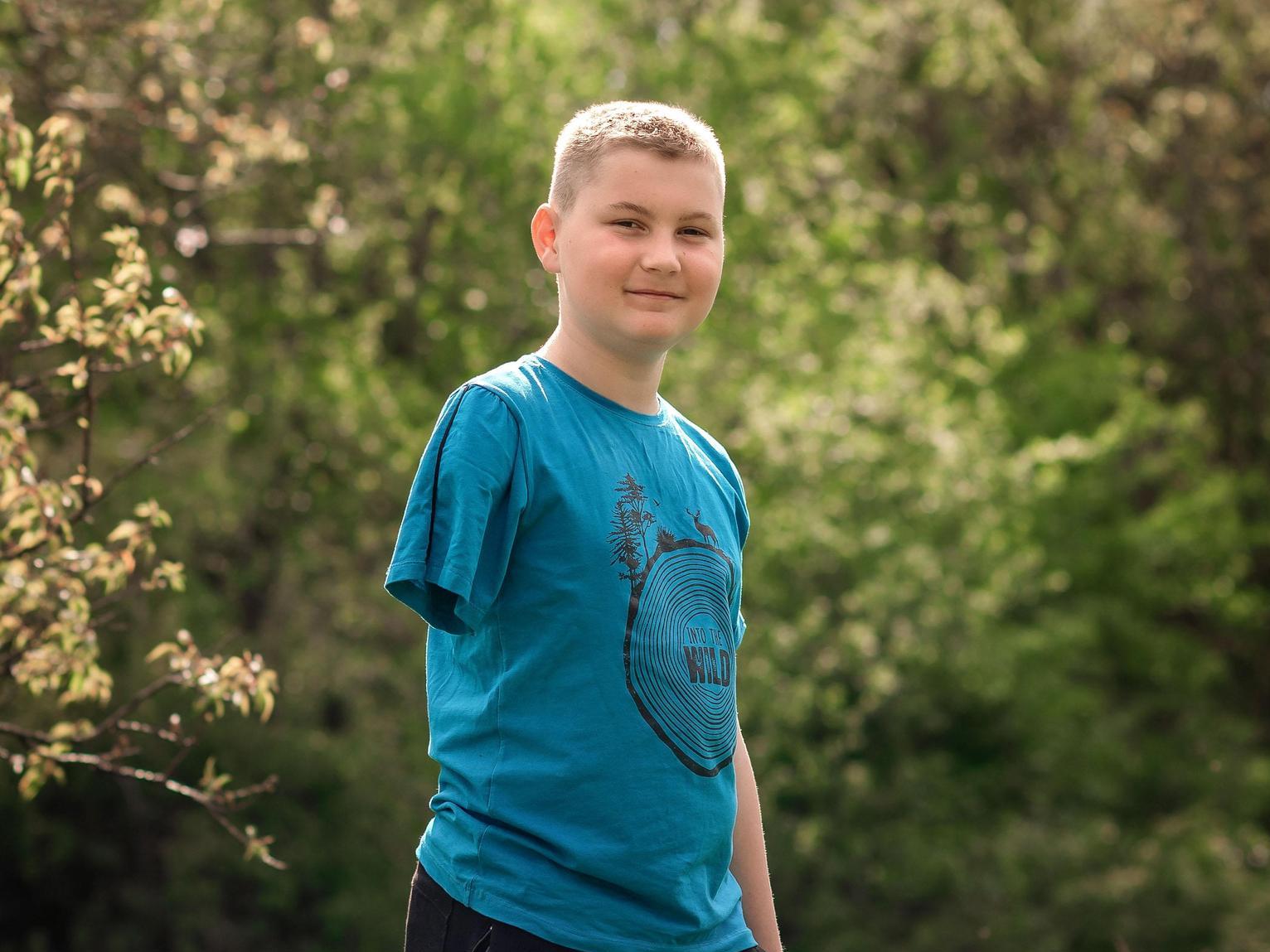 Yegor lost his right arm: he needs a bionic prosthesis