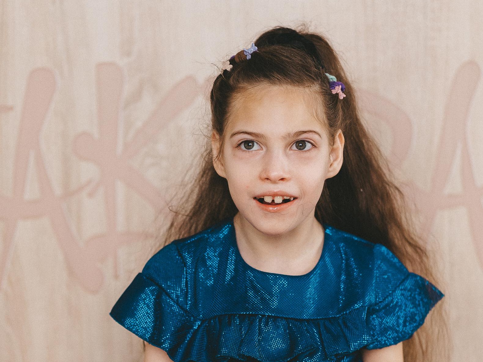 Zlata needs rehabilitation to learn to walk independently