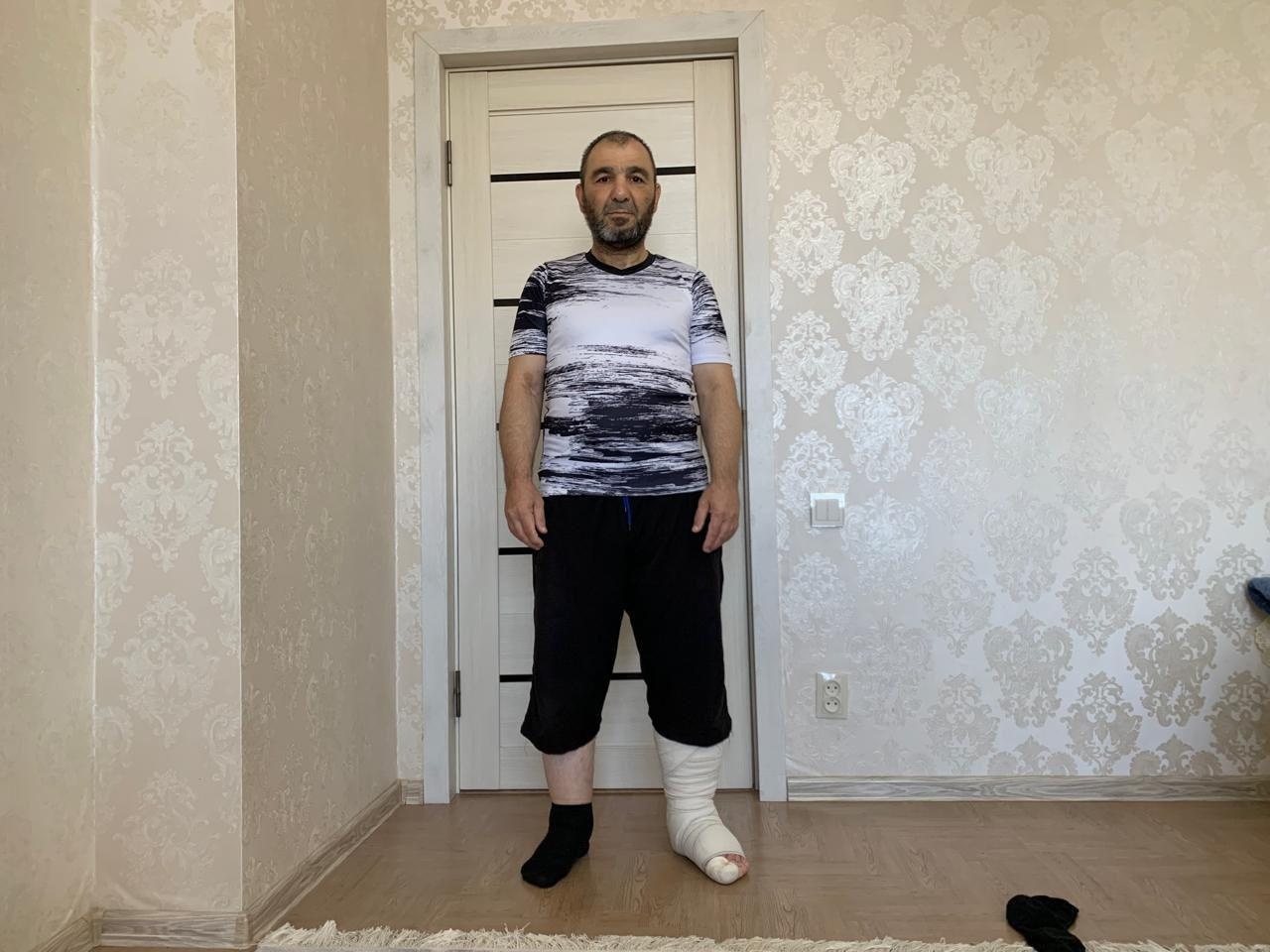У Али лимфостаз, ему нужна помощь, чтобы завершить лечение!