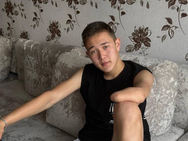 Саяну нужен легкий протез руки, чтобы не усугублять искривление позвоночника