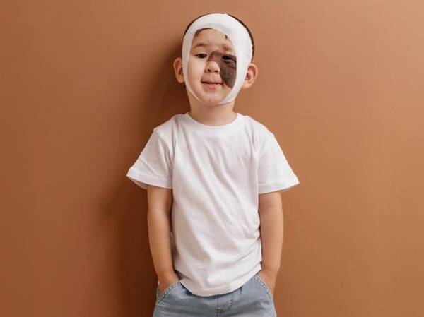 У Турганбая гигантский невус, ему нужна операция!