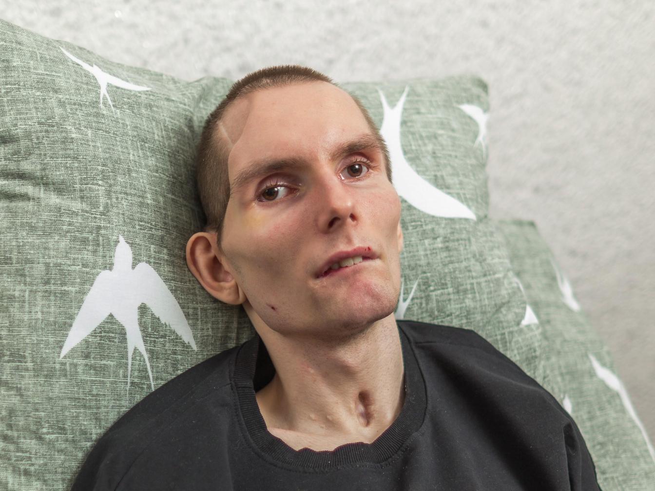 Stepan needs another course of rehabilitation to recover from the accident