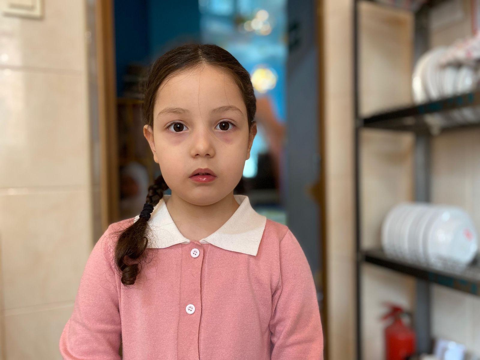 У Сафии РАС, и ей необходим курс реабилитации