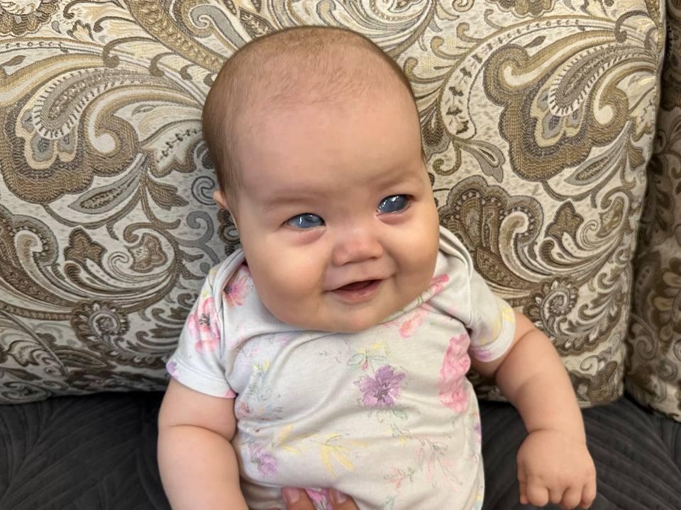 Aidana has glaucoma, she needs surgery!
