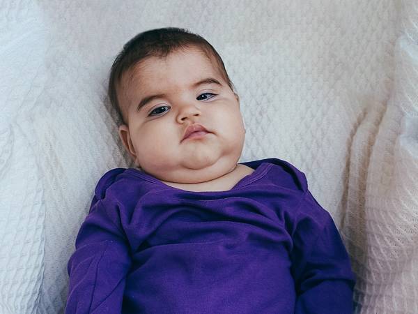 Маленькой Мадине требуется продолжение лечения ретинопатии недоношенных!