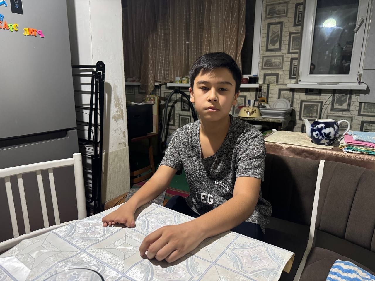 Tullo needs a prosthetic hand to be independent and confident
