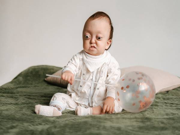 У Вити сложнaя патология, ему нужна операция, чтобы исправить череп