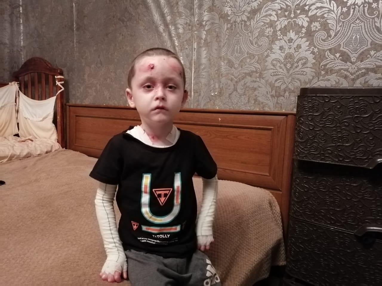 Muslim needs bandages, bandages and ointments!
