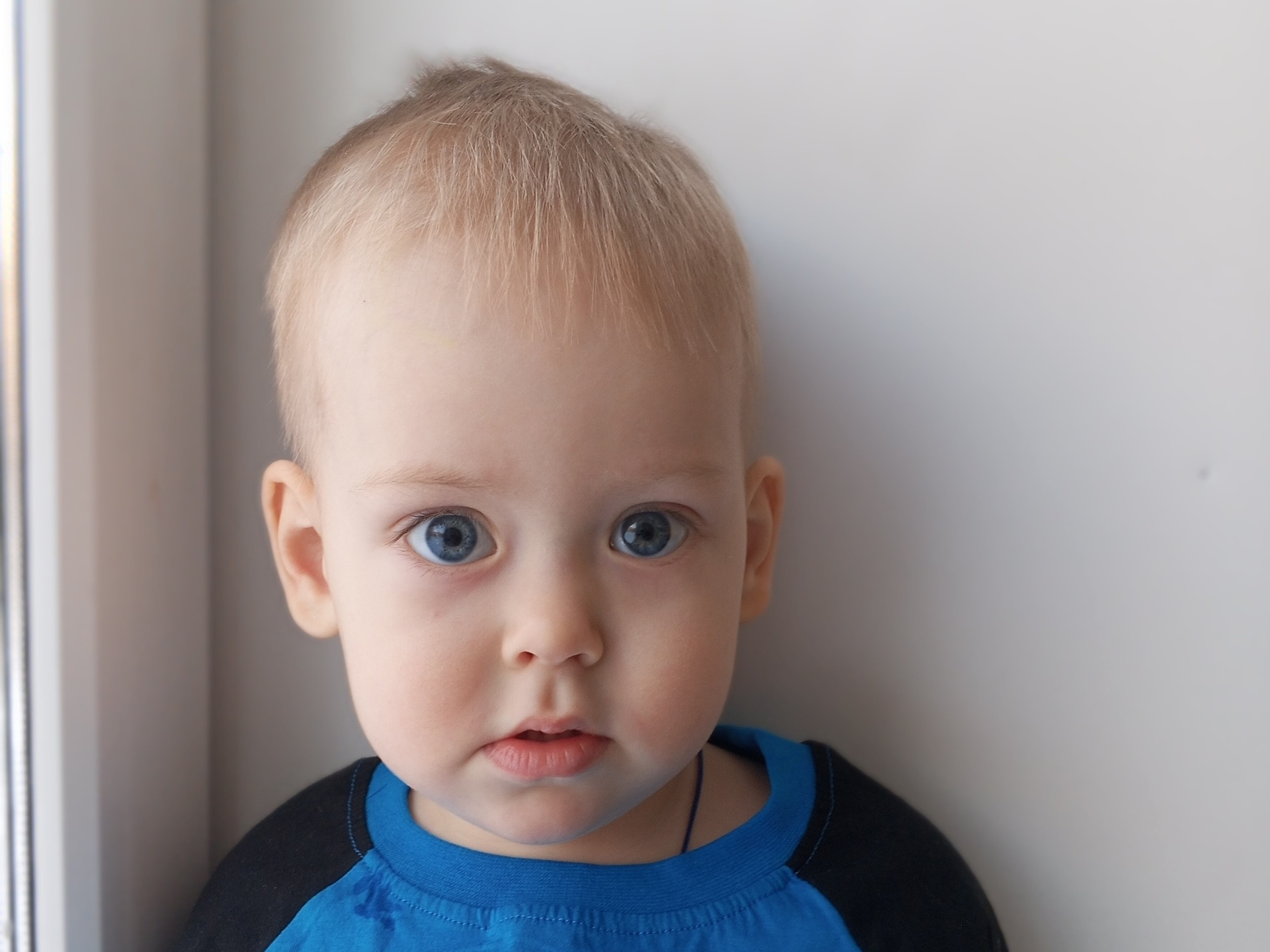У Тимофея spina bifida, ему необходима реабилитация