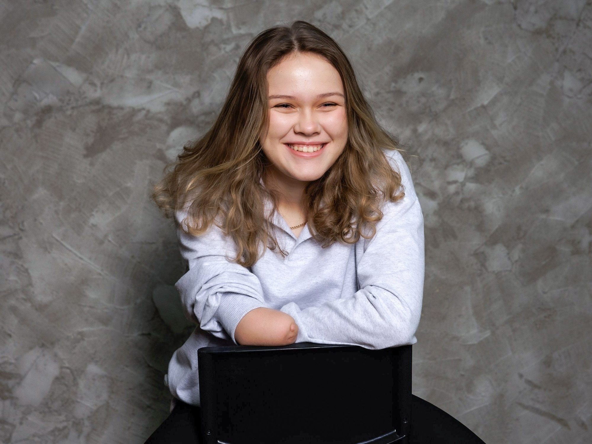 A bionic prosthesis will help Masha cope with any tasks in her studies and life.