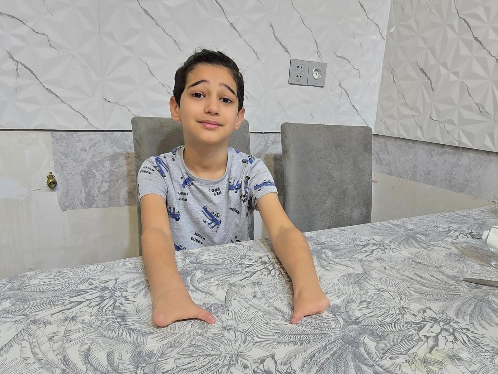 Yusif needs traction prosthetic arms