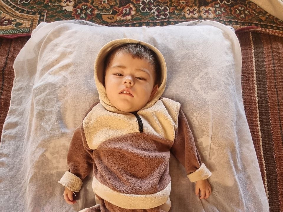 У Фотимы ретинопатия 5 степени, ей необходима операция