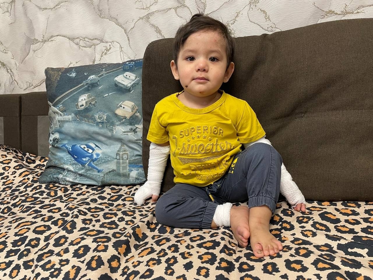 Muslim has a genetic disease - we need your support in purchasing bandages to protect the skin.
