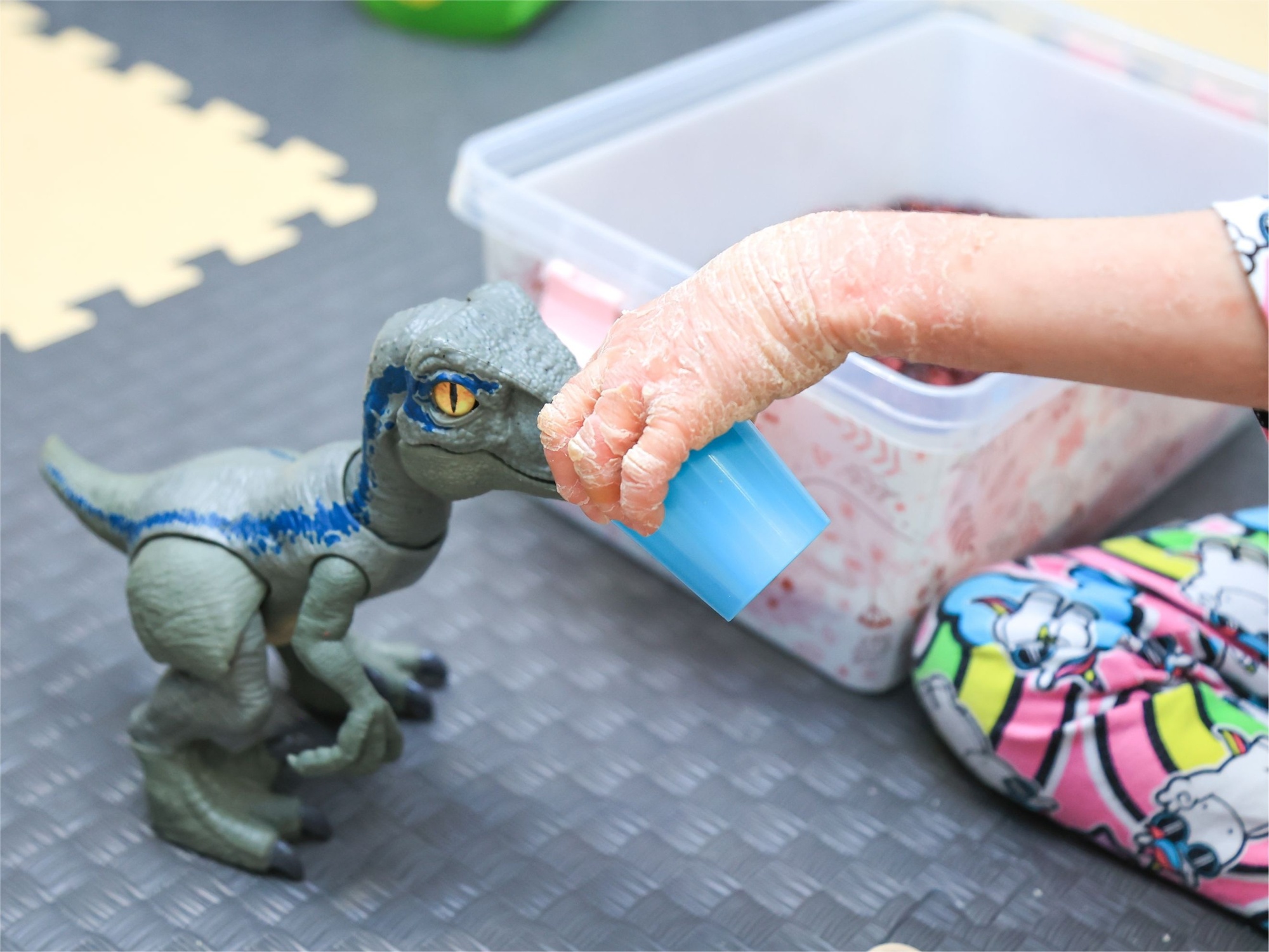 Children with rare genetic diseases need therapy to process sensory signals properly