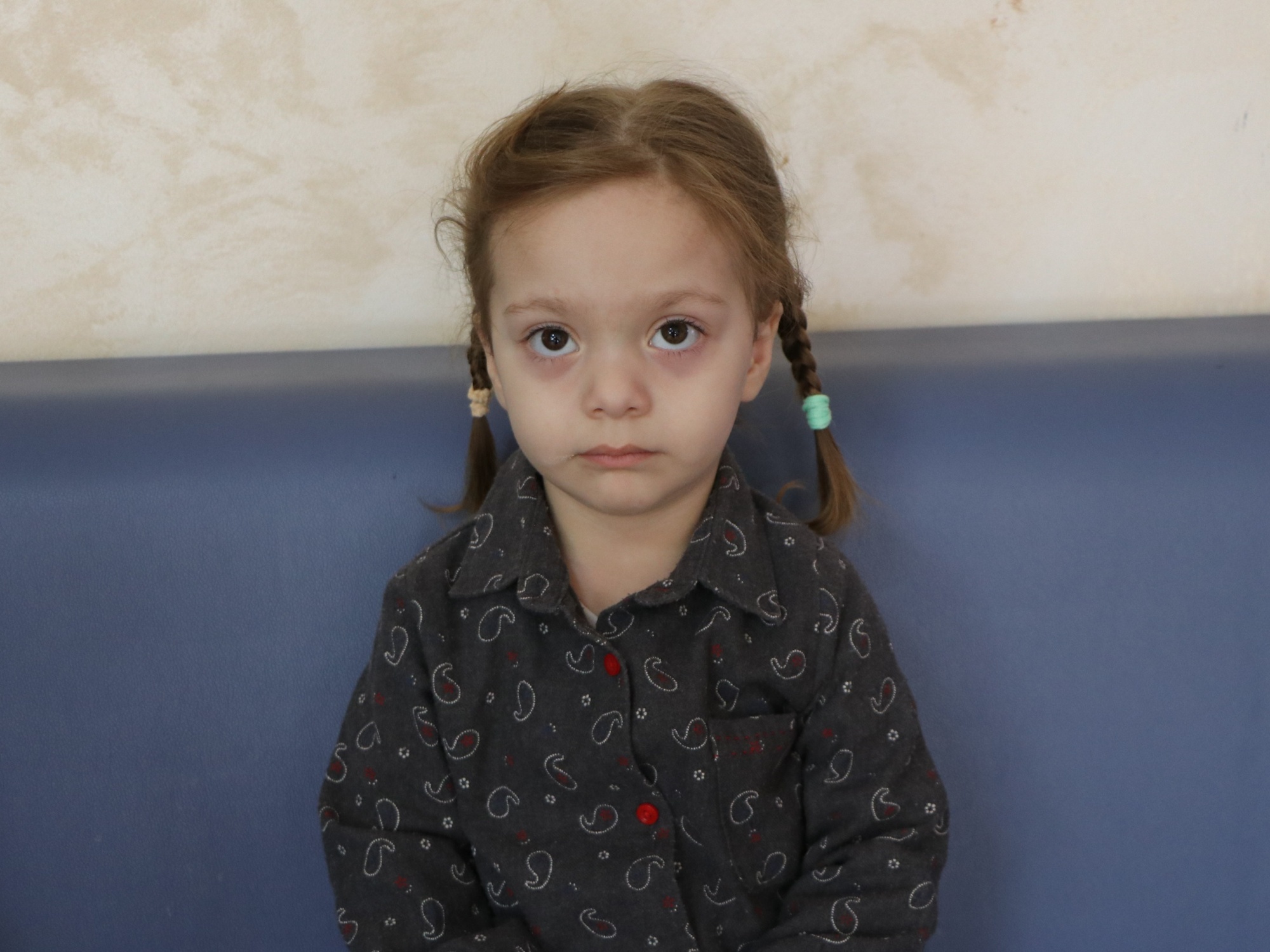 У малышки Хяди расщелина твёрдого нёба, давайте поможем ей пройти реабилитацию!