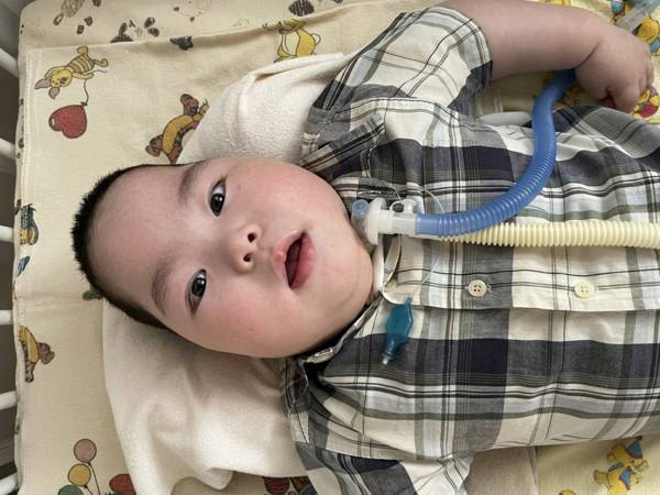 Азан сирота с тяжёлыми диагнозами. Помогите сохранить для него возможность дышать!