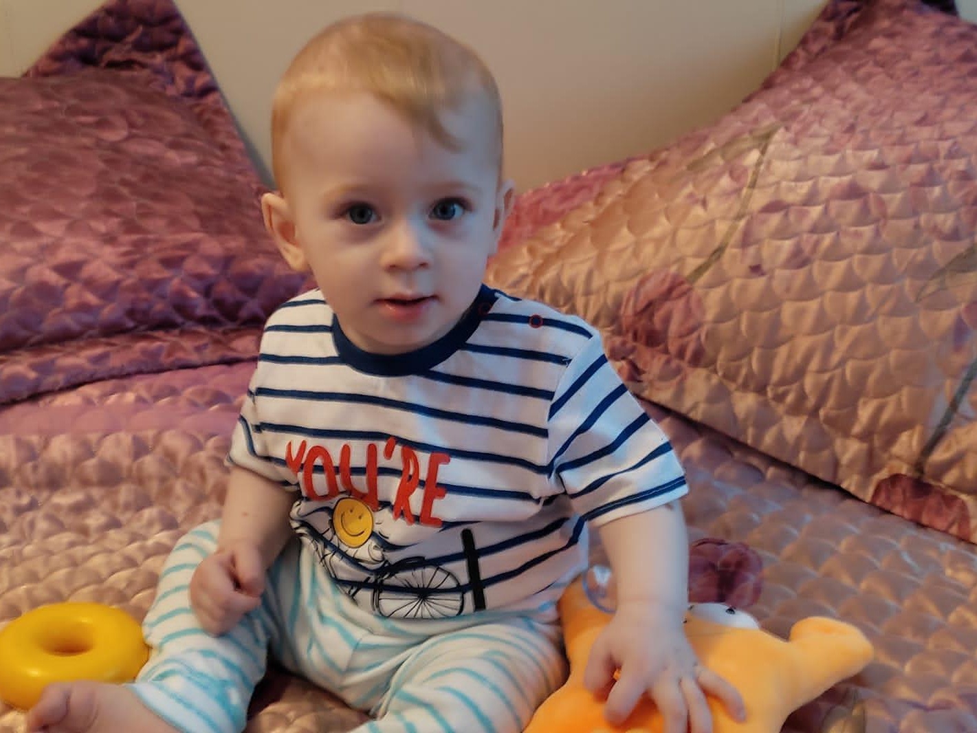 10-month-old Kirill with severe skin condition needs surgery!