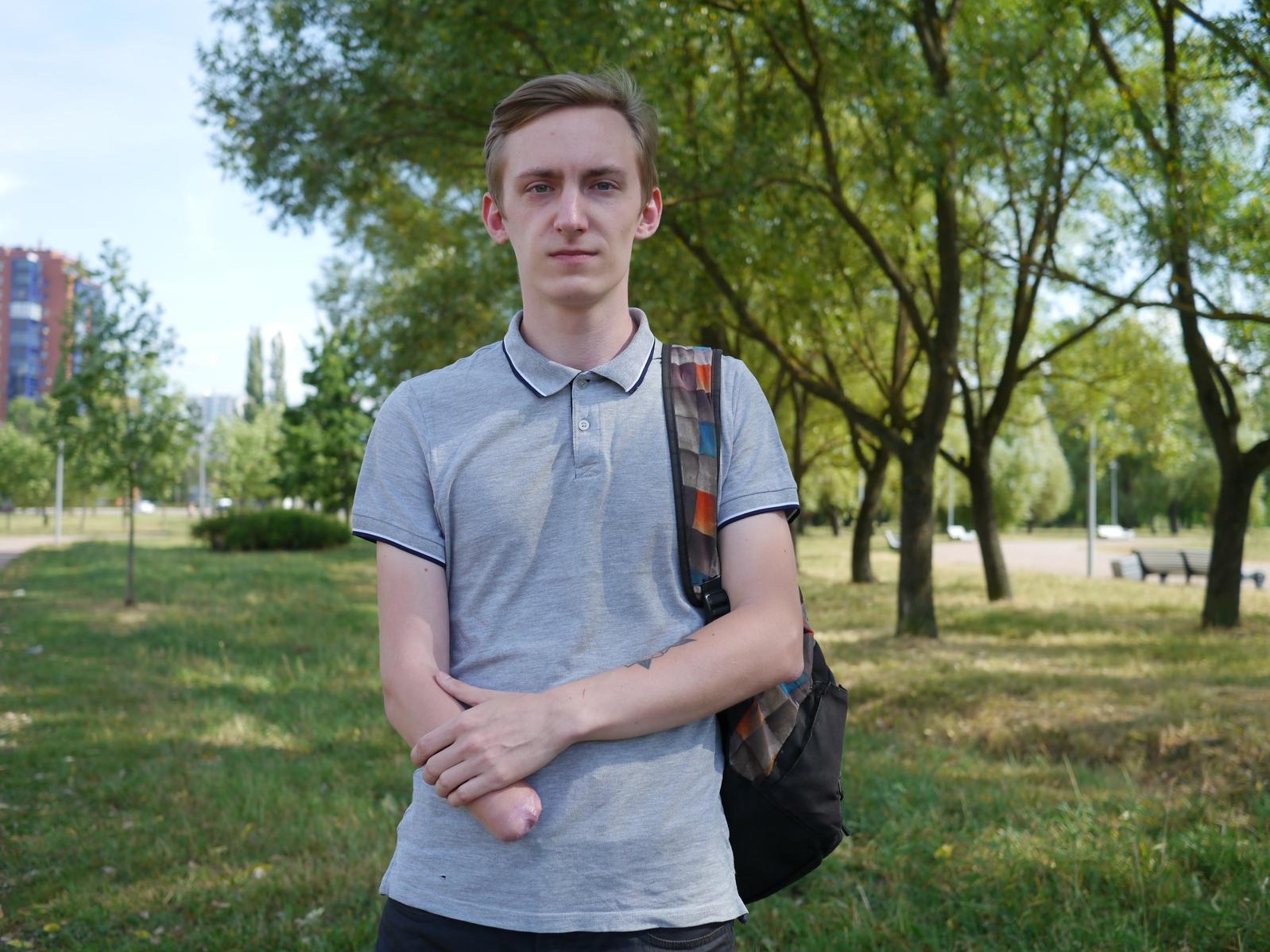 Andrei needs prosthetics for his right hand!