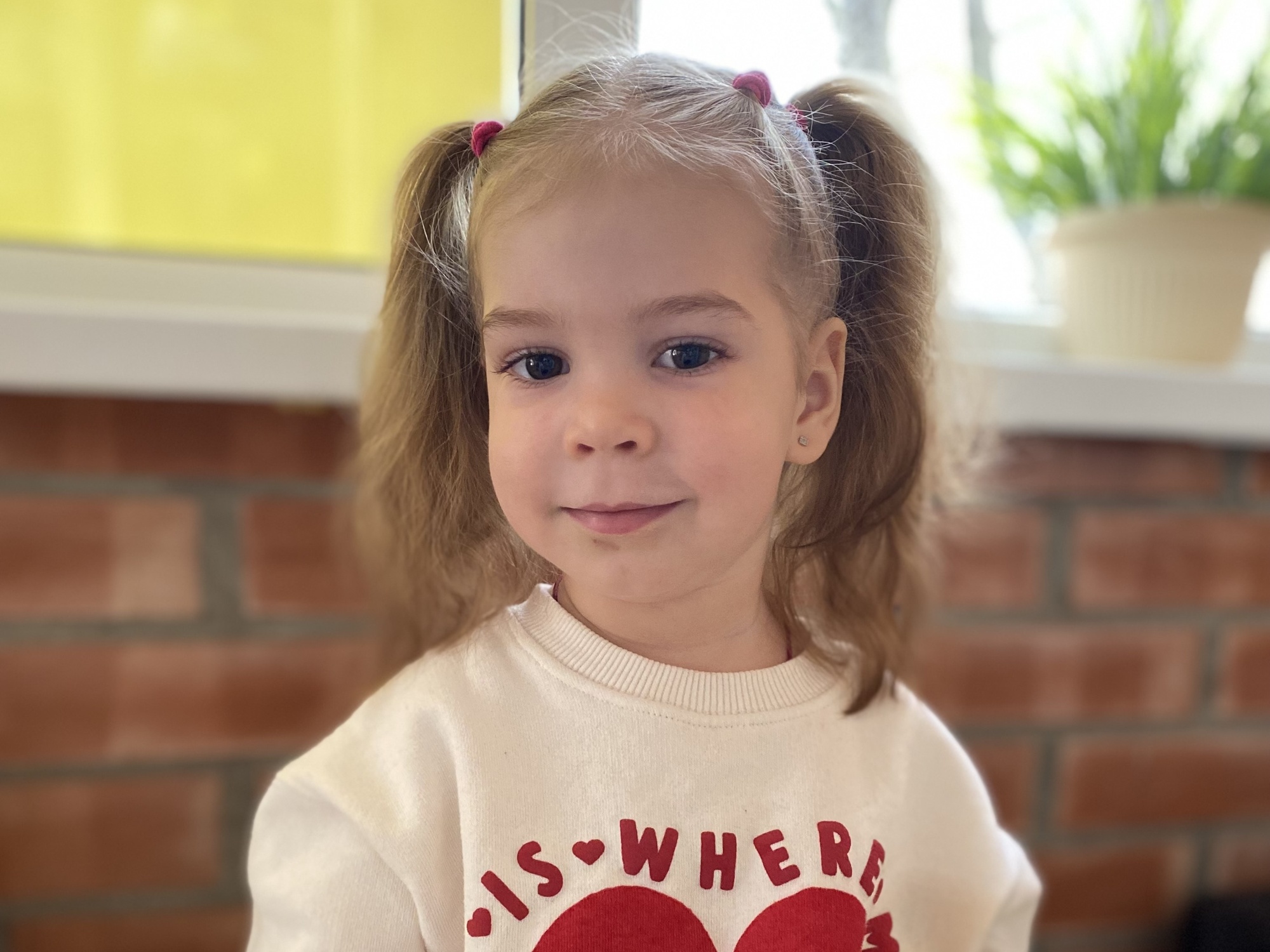 Alice has a severe form of epilepsy and requires a special treatment method involving a ketogenic diet