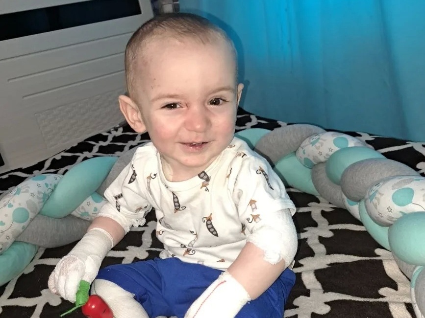 У Глеба буллёзный эпидермолиз, ему нужны специальные средства для кожи