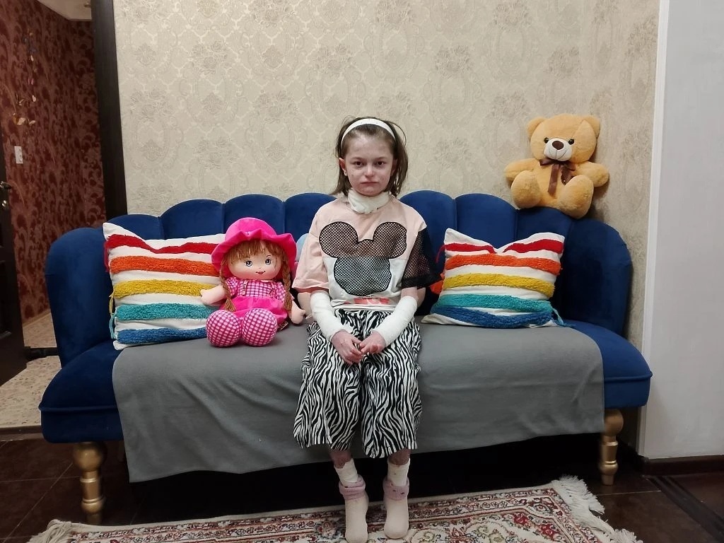 У Нурайнат генетическое заболевание. Ее кожа нуждается в защите - поможем закупить специальные повязки и уходовые средства