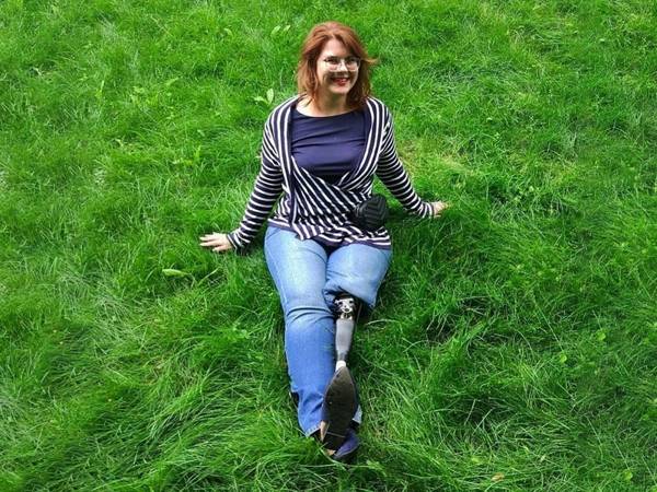 Екатерине необходим спортивный протез бедра, чтобы она могла бегать!