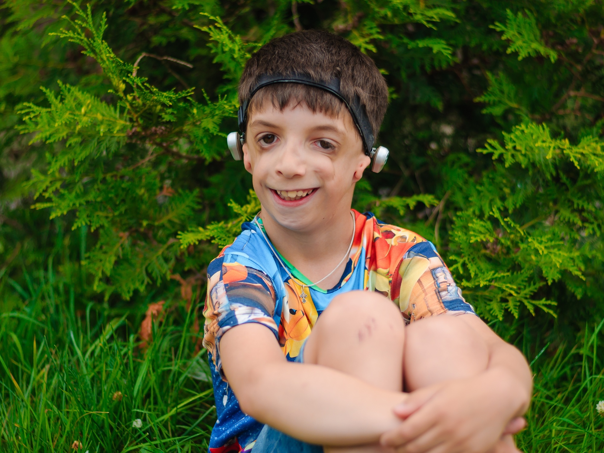 Roma needs hearing and speech rehabilitation: he dreams of speaking clearly and clearly!