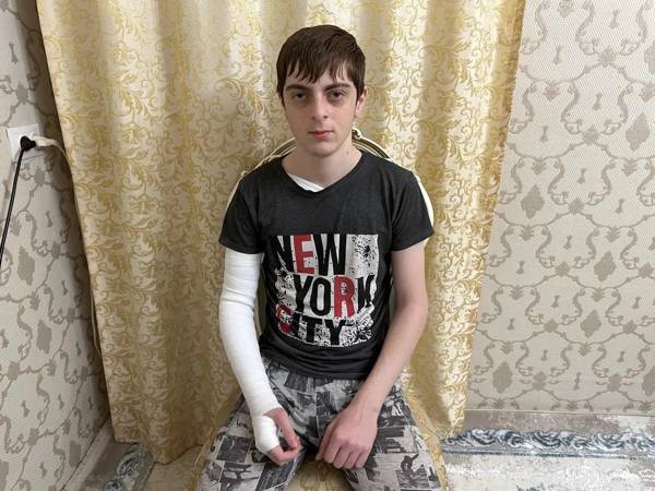 Дибиру необходим курс лечения лазером!