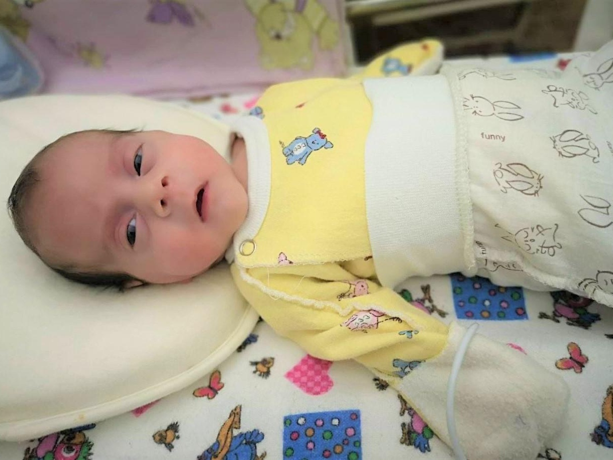 A newborn Adele needs a surgery which can save her eyesight!