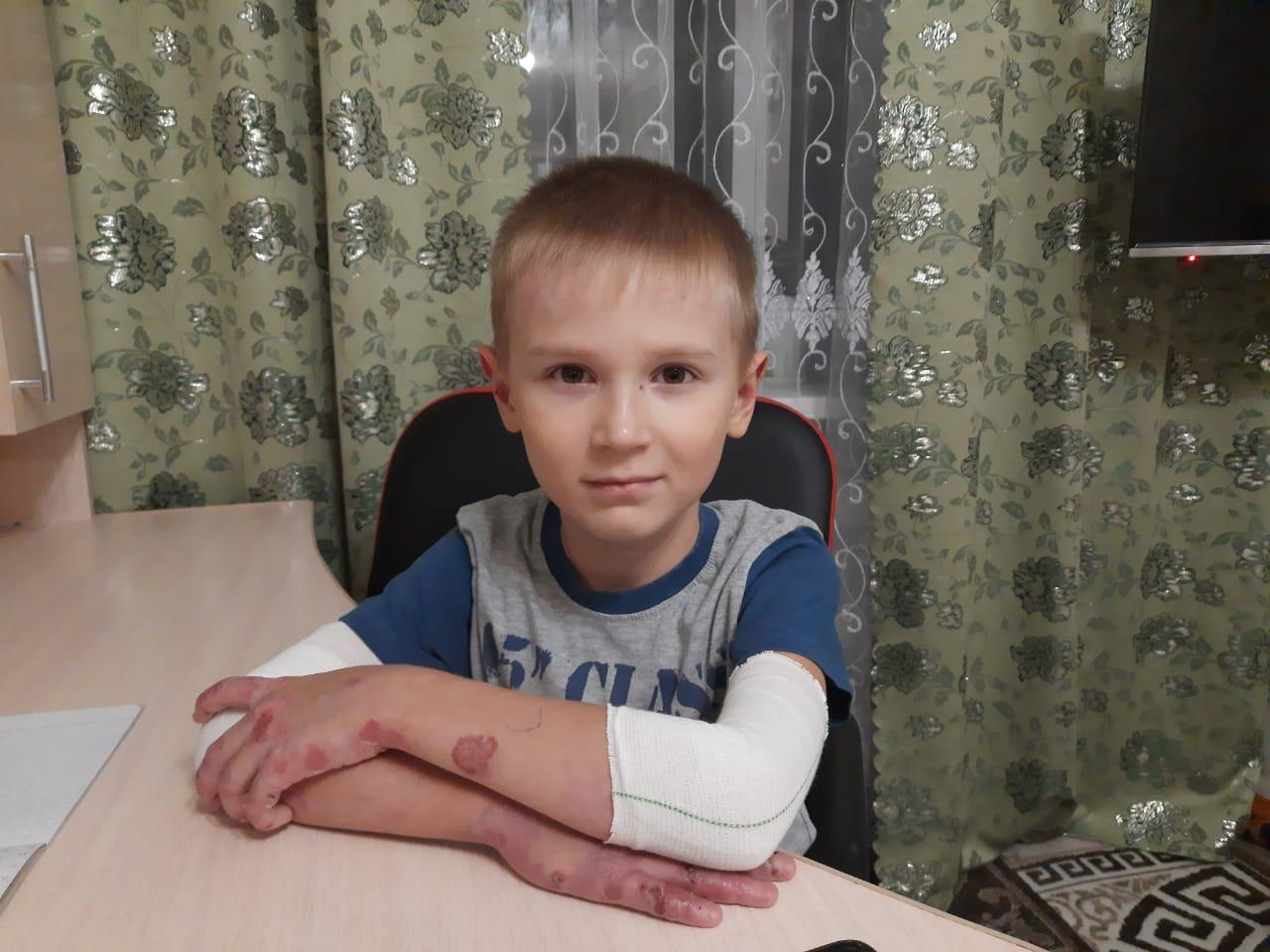 Бинты и кремы необходимы маленькому Семену!