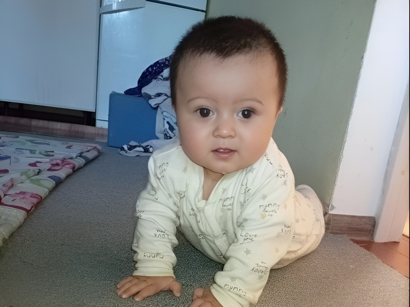 Ismoil has retinoblastoma, he needs chemotherapy!
